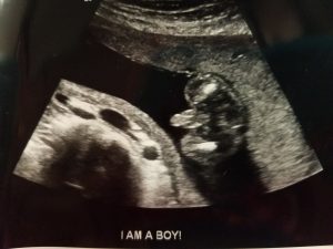 20 week ultrasound potty shot, boy